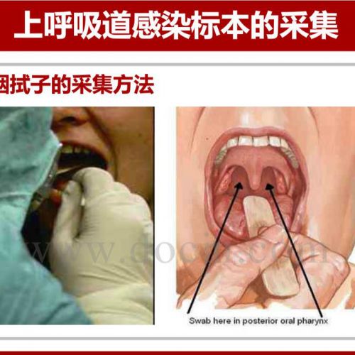 呼吸道感染：病毒样本采集的重要性及规范要求