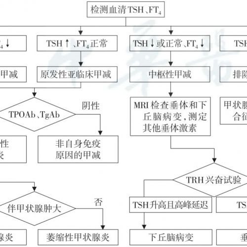 指南共识 | 甲状腺功能减退症基层诊疗指南（2019年）