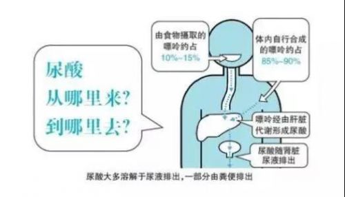 都是“尿酸”惹的祸