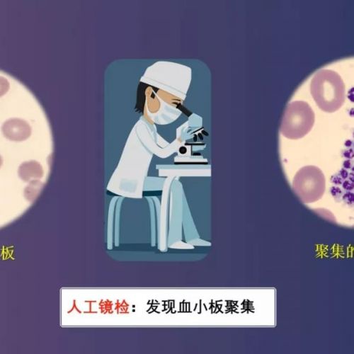 “调皮”的血小板