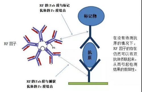 类风湿因子（RF）与假阳性剖析