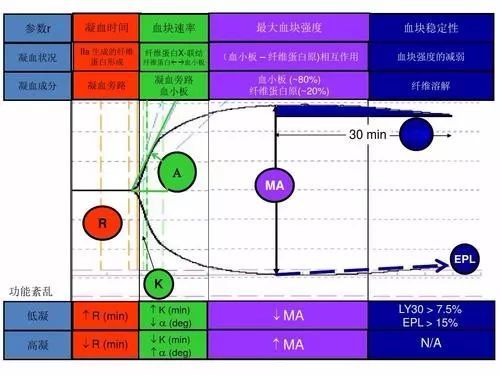 血栓弹力图检测在医院扮演什么角色？对临床有多重要！