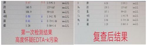 初入检验这行，那些年遇过的“坑”！
