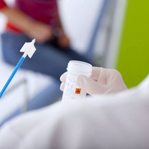 宫颈癌筛查同时检测 TCT 和 HPV ，应先取哪一个？