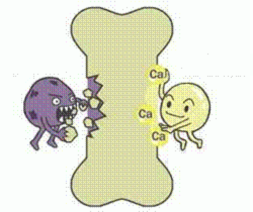 骨代谢三项的临床意义