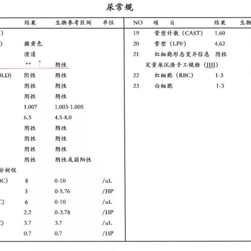 别再被尿蛋白加号（+）骗了，更准的是这两个检查！
