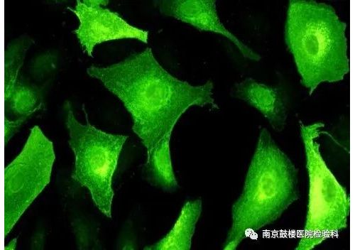 呼吸道病原体谱抗体IgM检测！