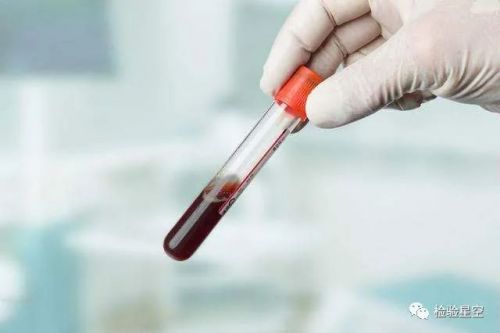 【检验项目】全面了解甲状腺功能检测！