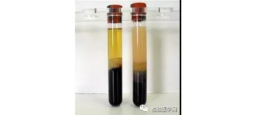 【检验案例】戏剧性的甘油三酯