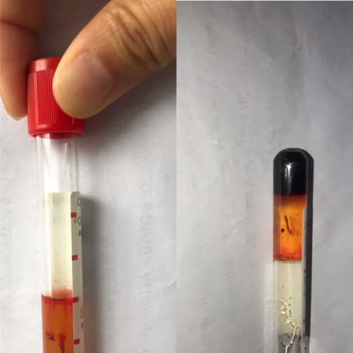 一份离不出血清的标本