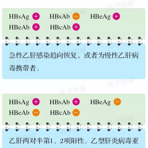 乙肝检验结果的25种可能，大科普！