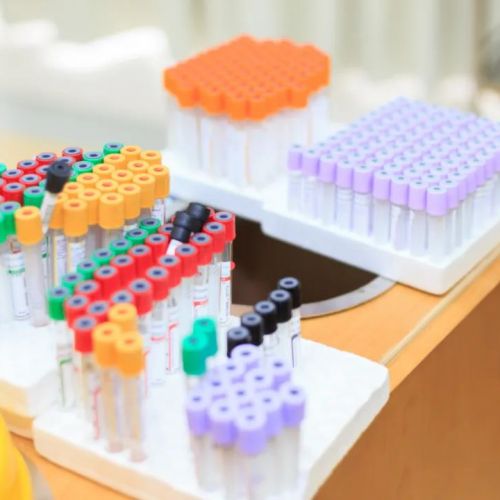 性激素六项怎么都看不懂？需注意3个关键点！