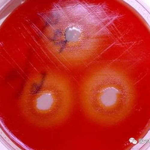 检验医学中的卫星现象