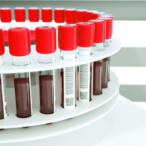 甲状腺功能，到底查三项还是查五项？