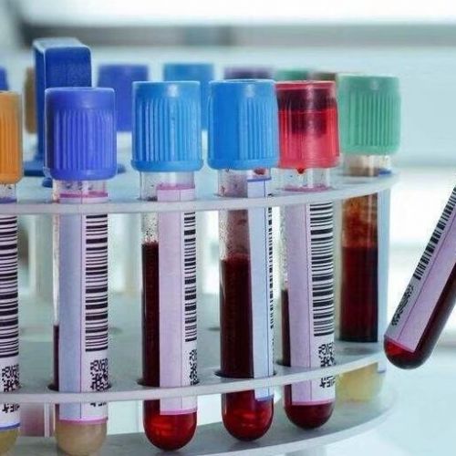 心肌酶、血脂、贫血、肝肾功能等51项生化检验项目解读