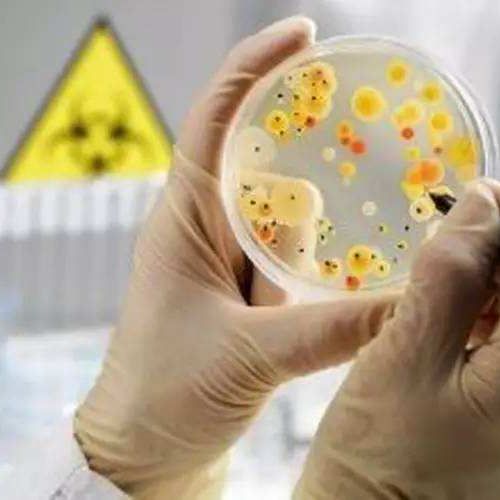 微生物检验中常用的生化反应实验有哪些？