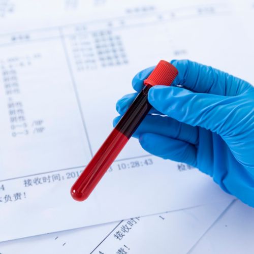 血气分析与生化结果不一致，该以哪个为准？