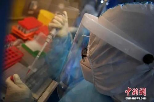 注意！联防联控机制医疗救治组：全面检查医学检验实验室