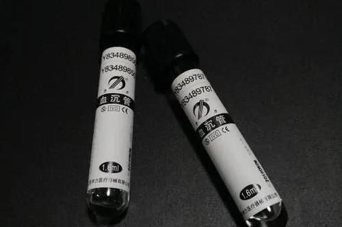 血沉结果如何判读？