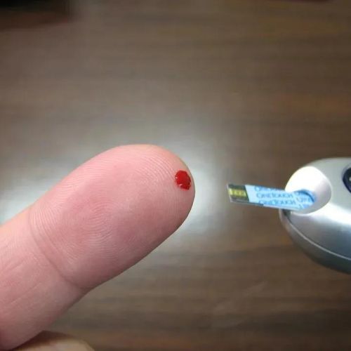 测血糖，末梢血和静脉血，哪个更准？