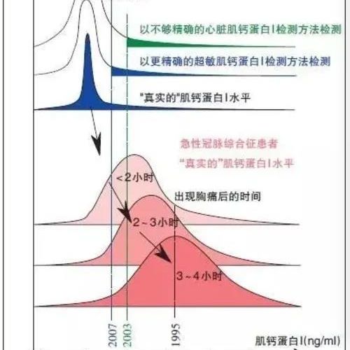 肌钙蛋白升高，除了怀疑心梗还应如何考虑？