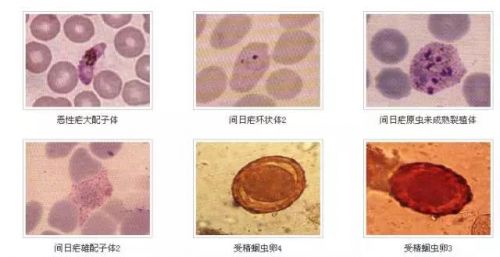 检验图谱｜寄生虫图片整理