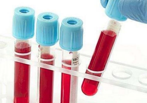 诊断慢性乙型肝炎：HBV DNA检测知多少？