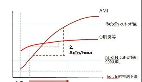 超敏肌钙蛋白，心梗检测的新时代