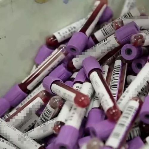 检验科的血标本最后去哪儿了？当然不是你想象中的毛血旺