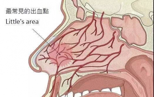 鼻出血是上火？一文读懂鼻出血的那些事