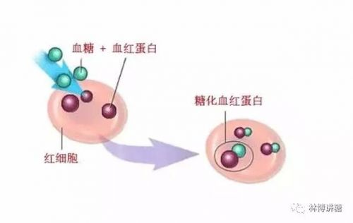糖化血红蛋白高，可以诊断糖尿病吗？