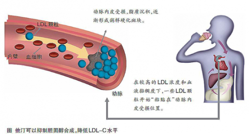 血管特异性炎症标志物——脂蛋白相关磷脂酶A2