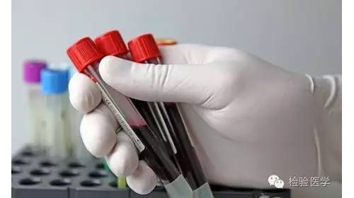 教你如何读懂梅毒RPR和TPPA检验报告单，如何利用RPR和TPPA判断病情 ...