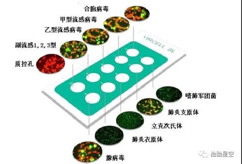 检验项目 | 呼吸道九联检的临床意义