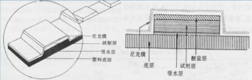 尿干化学与尿沉渣不符，到底信哪个？！