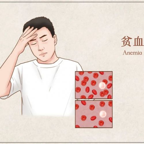 贫血就要补补补？先来看看到底是什么贫血