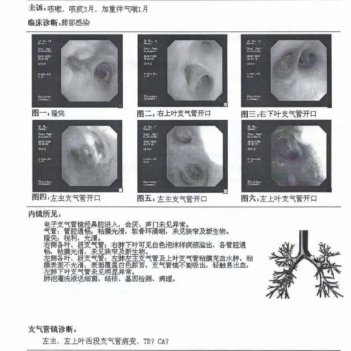 痰涂片中的“学问”