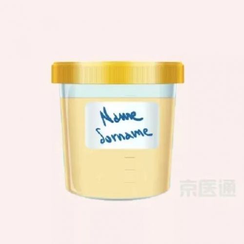大白话解读肝肾功能报告，不学医也秒懂