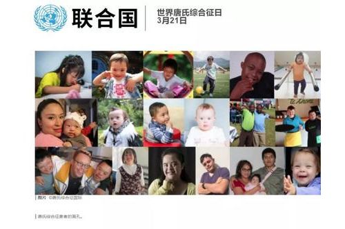 【聚焦3·21】世界唐氏综合征日