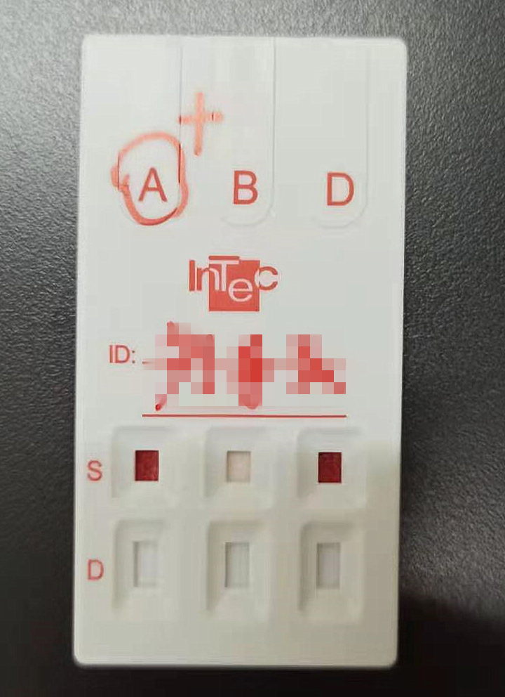 血型检测卡结果图图片