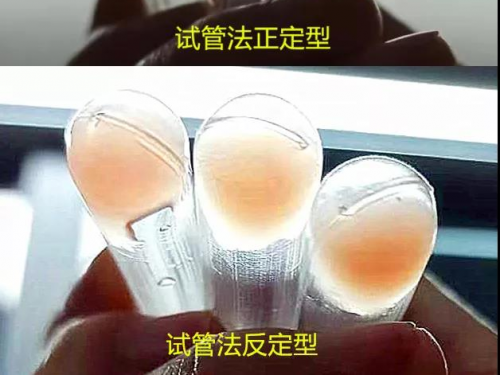 血型鉴定如何排除获得性类 B 抗原？