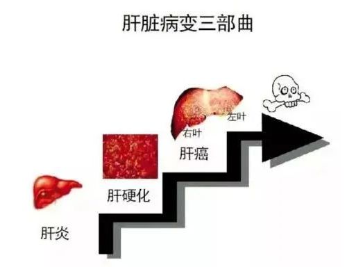 揭秘 | HBV RNA在慢性乙肝诊疗中究竟有何“神通”？