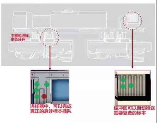 实验室智能化专题 | 浅论急诊检验流水线