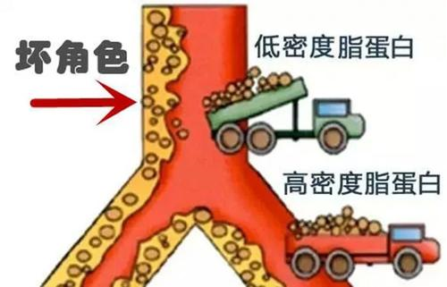 低密度脂蛋白、小而密低密度脂蛋白、氧化低密度脂蛋白究竟有什么区别？ ...