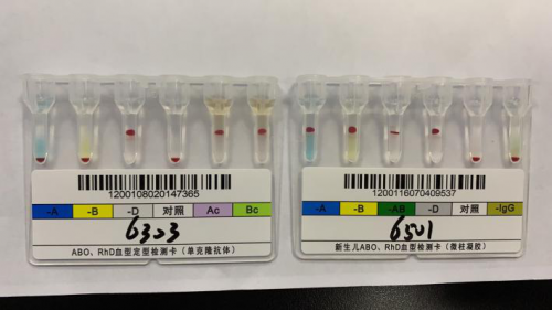 我B型血，老婆O型血，这个AB型血的孩子是谁的？