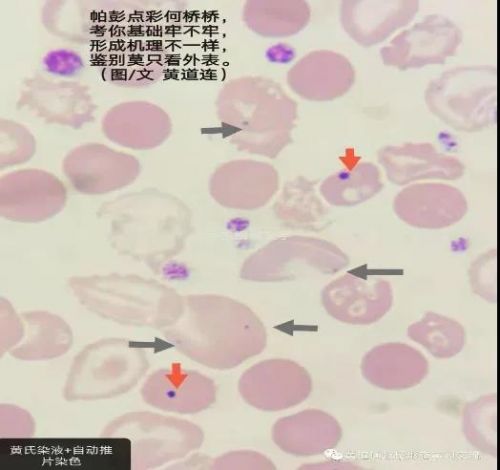 红细胞内的“狂欢节”