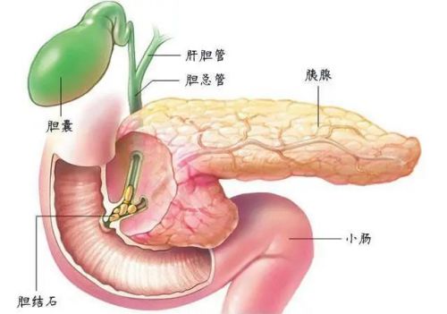 比癌症更可怕的炎症，容易盯上4类人