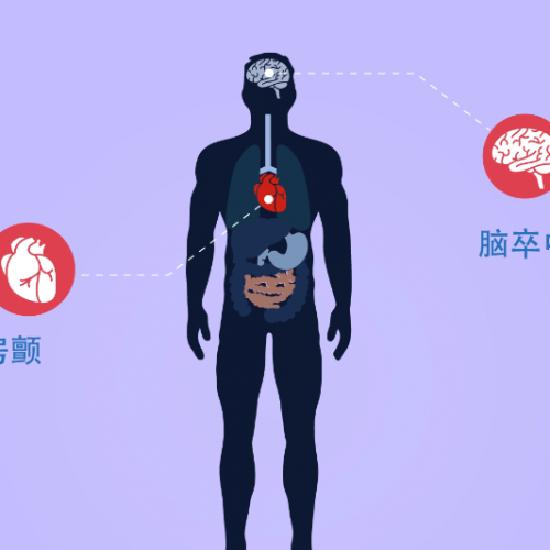 高血压会诱发房颤吗？这几点你必须要知道！