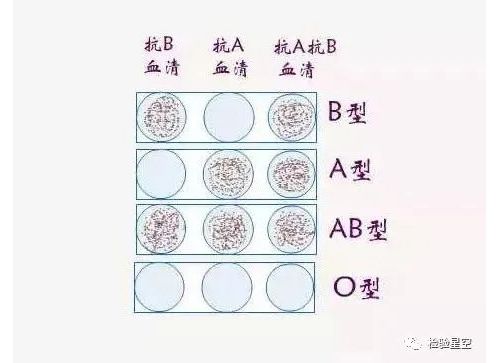 常见交叉配血试验方法及注意事项