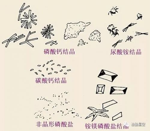 建议收藏 | 检验图谱体液合集